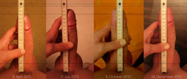 Phallosan Forte Before and After Pictures.